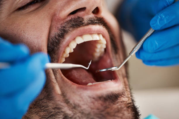 Best Urgent Tooth Repair  in Chappaqua, NY
